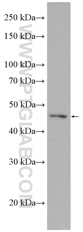 Western Blot (WB) analysis of HeLa cells using XIAP Polyclonal antibody (10037-1-Ig)