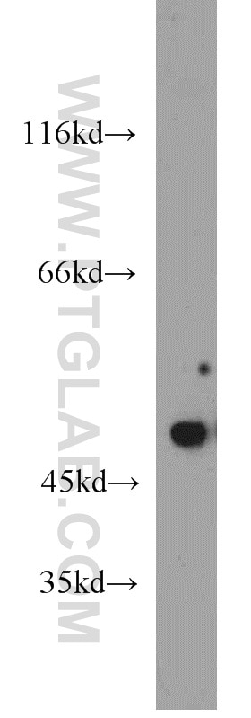 Western Blot (WB) analysis of Jurkat cells using XIAP Polyclonal antibody (10037-1-Ig)