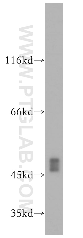 Western Blot (WB) analysis of COLO 320 cells using XIAP Polyclonal antibody (10037-1-Ig)