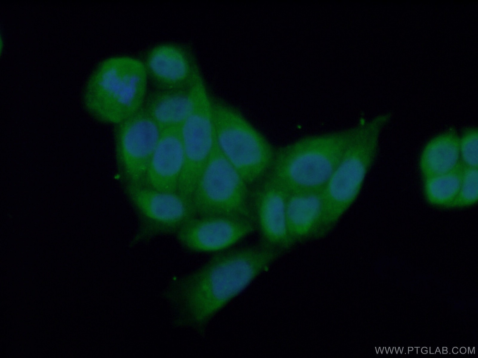 Immunofluorescence (IF) / fluorescent staining of HeLa cells using XIAP Polyclonal antibody (23453-1-AP)