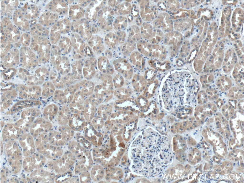 Immunohistochemistry (IHC) staining of human kidney tissue using XIAP Polyclonal antibody (23453-1-AP)