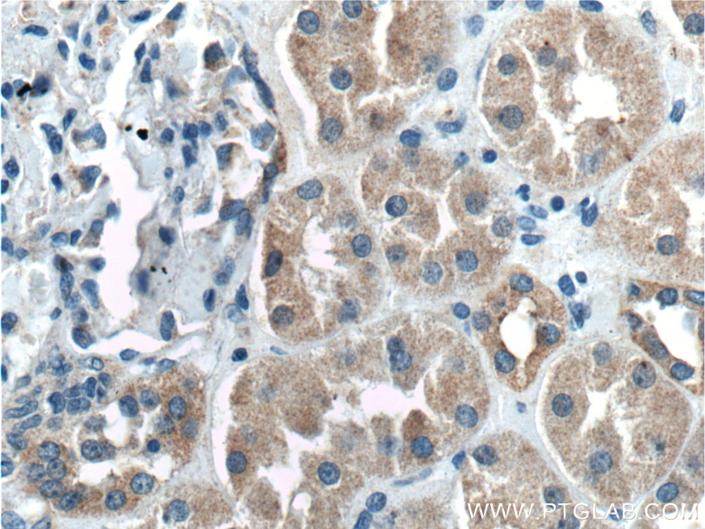 Immunohistochemistry (IHC) staining of human kidney tissue using XIAP Polyclonal antibody (23453-1-AP)