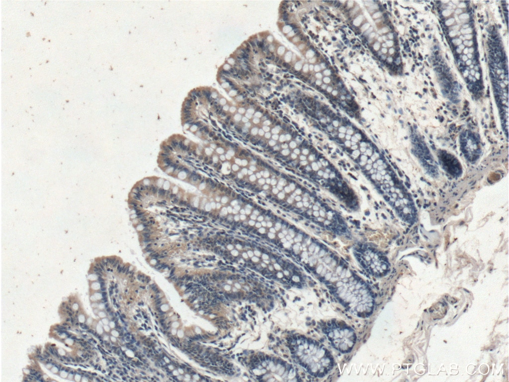 Immunohistochemistry (IHC) staining of human colon tissue using XIAP Polyclonal antibody (23453-1-AP)