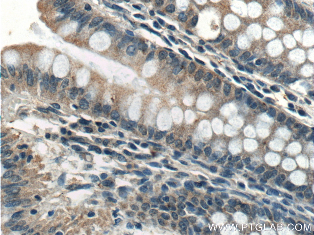 Immunohistochemistry (IHC) staining of human colon tissue using XIAP Polyclonal antibody (23453-1-AP)