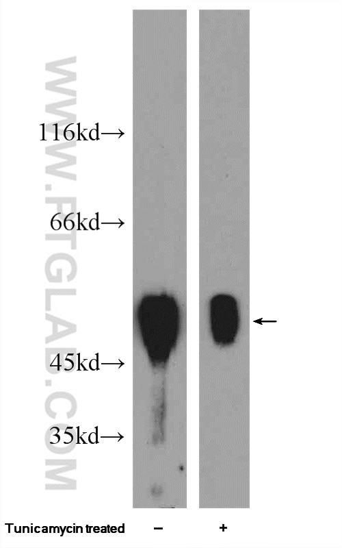 Western Blot (WB) analysis of HepG2 cells using XIAP Polyclonal antibody (23453-1-AP)