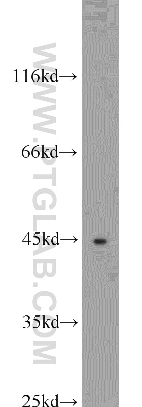 Western Blot (WB) analysis of C6 cells using XIAP Polyclonal antibody (23453-1-AP)