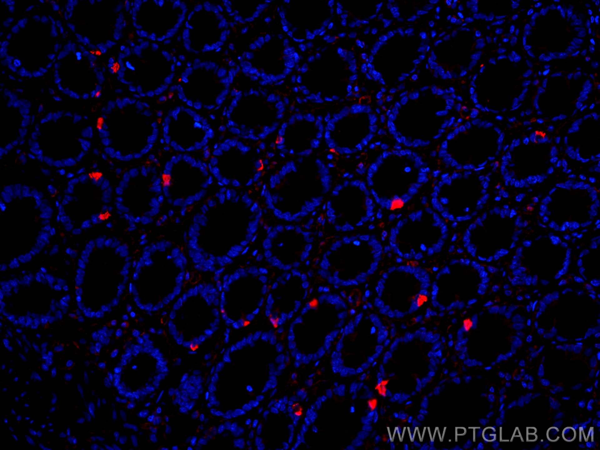 Immunofluorescence (IF) / fluorescent staining of human colon tissue using XIAP Monoclonal antibody (66800-1-Ig)