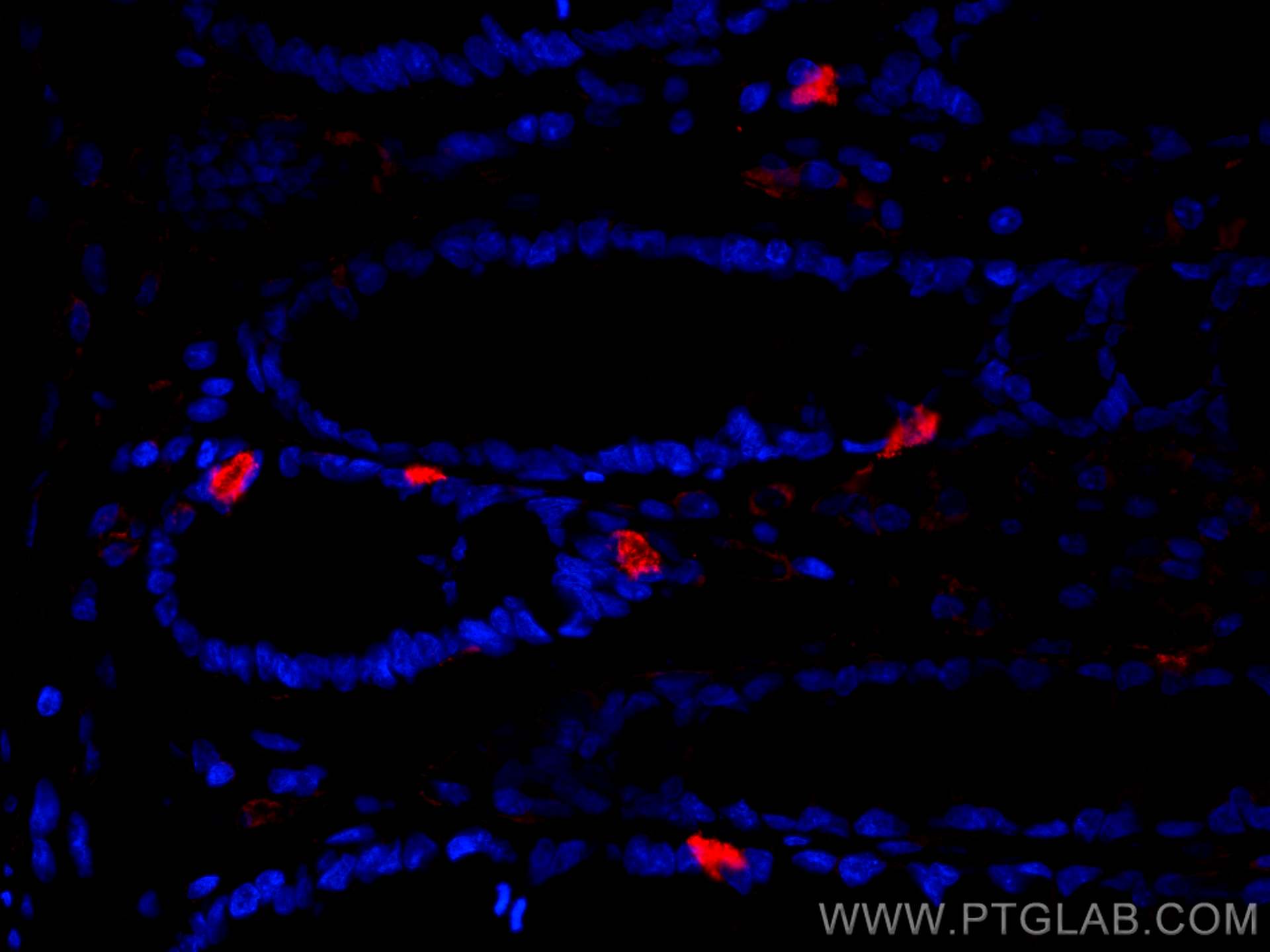 Immunofluorescence (IF) / fluorescent staining of human colon tissue using XIAP Monoclonal antibody (66800-1-Ig)
