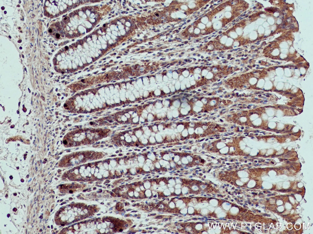 Immunohistochemistry (IHC) staining of human colon tissue using XIAP Monoclonal antibody (66800-1-Ig)