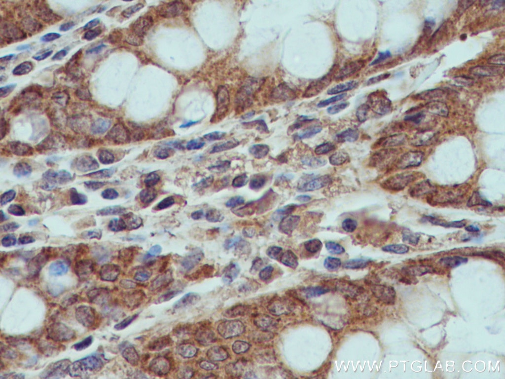 Immunohistochemistry (IHC) staining of human colon tissue using XIAP Monoclonal antibody (66800-1-Ig)