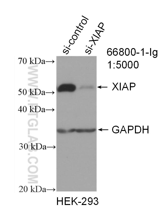 Western Blot (WB) analysis of HEK-293 cells using XIAP Monoclonal antibody (66800-1-Ig)