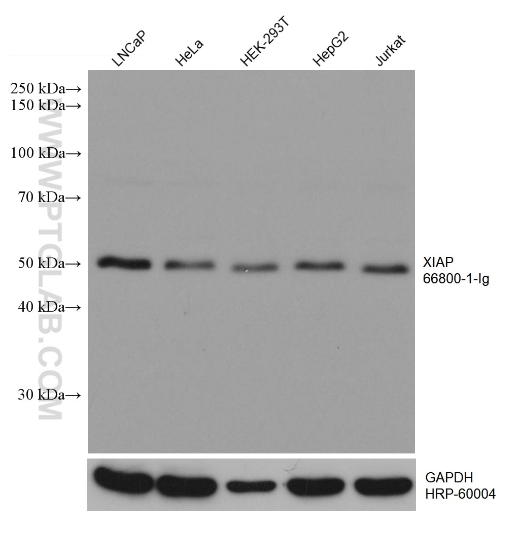 Western Blot (WB) analysis of various lysates using XIAP Monoclonal antibody (66800-1-Ig)