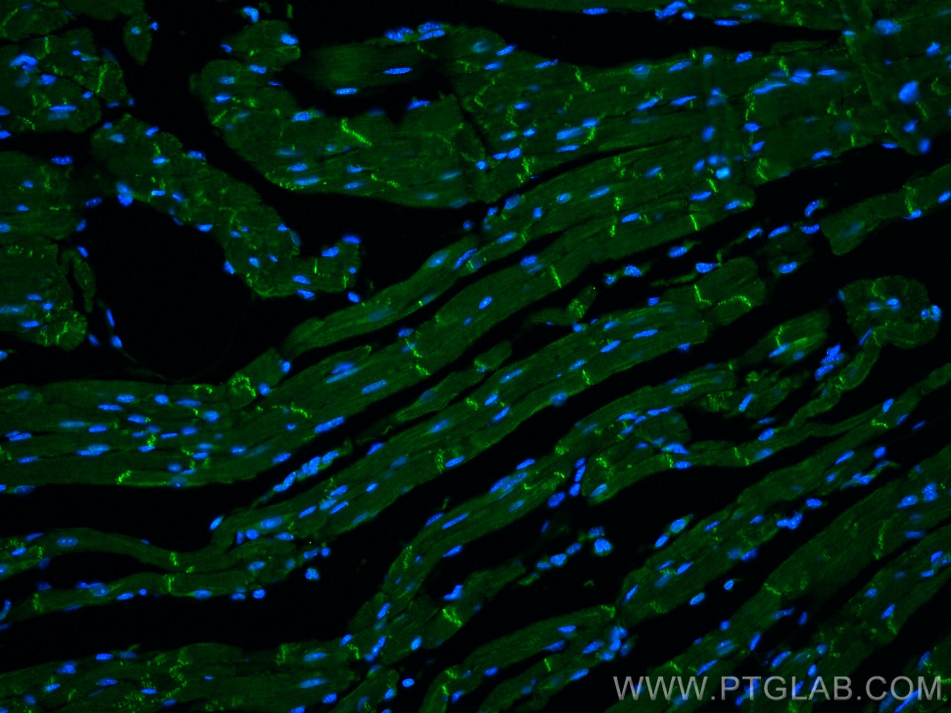 Immunofluorescence (IF) / fluorescent staining of mouse heart tissue using XIRP2 Polyclonal antibody (11896-1-AP)