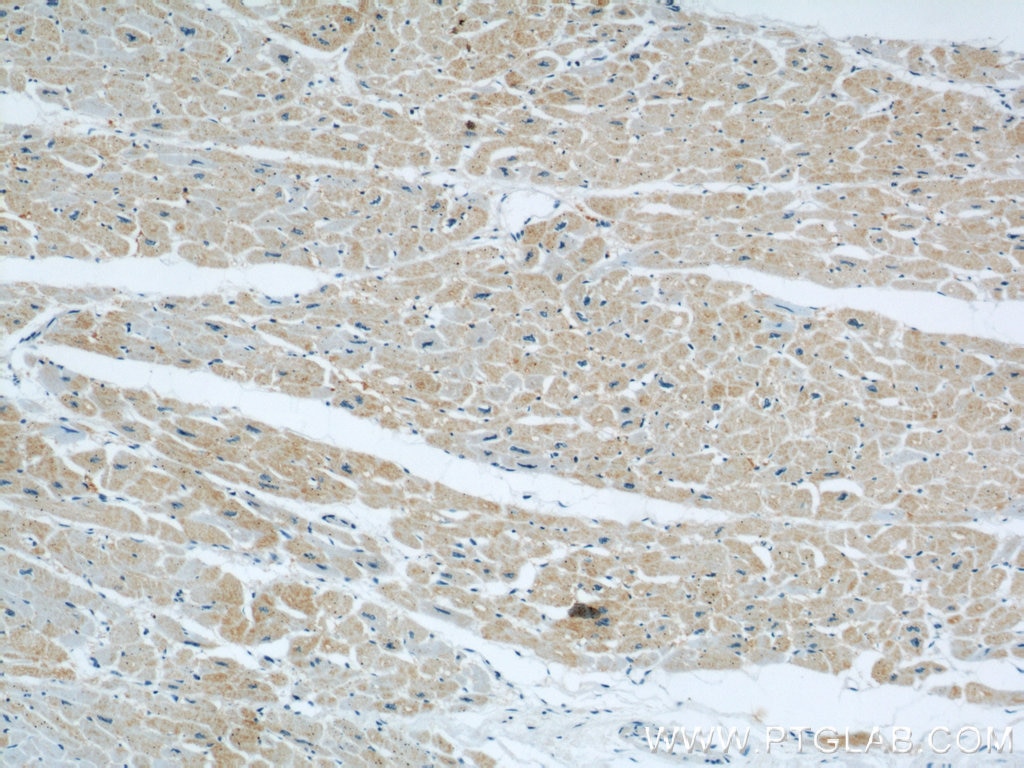 Immunohistochemistry (IHC) staining of human heart tissue using XIRP2 Polyclonal antibody (11896-1-AP)
