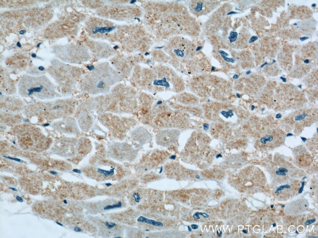 Immunohistochemistry (IHC) staining of human heart tissue using XIRP2 Polyclonal antibody (11896-1-AP)