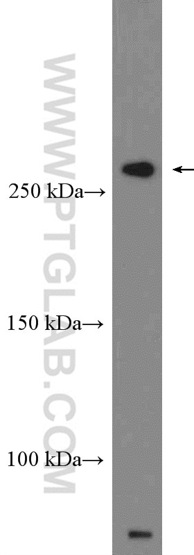 Western Blot (WB) analysis of Caco-2 cells using XIRP2 Polyclonal antibody (11896-1-AP)