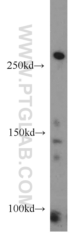 Western Blot (WB) analysis of human heart tissue using XIRP2 Polyclonal antibody (11896-1-AP)