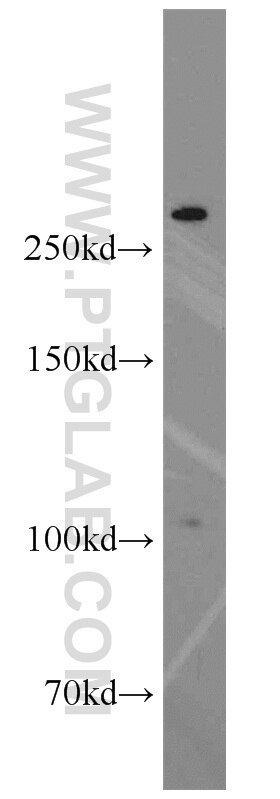 Western Blot (WB) analysis of COLO 320 cells using XIRP2 Polyclonal antibody (11896-1-AP)