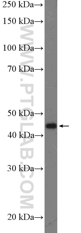 WB analysis of mouse pancreas using 12830-1-AP