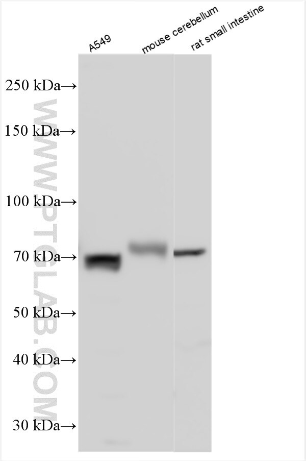 Western Blot (WB) analysis of various lysates using XKR4 Polyclonal antibody (32981-1-AP)