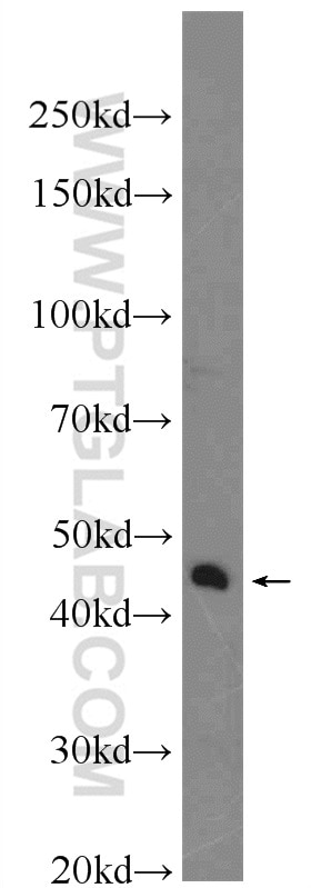 Western Blot (WB) analysis of Jurkat cells using XKR6 Polyclonal antibody (23968-1-AP)
