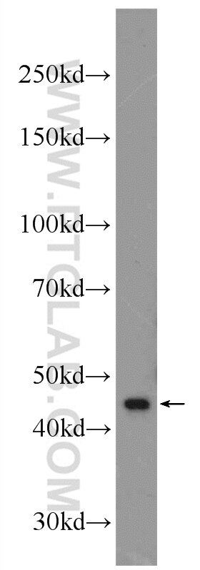 Western Blot (WB) analysis of Y79 cells using XKR6 Polyclonal antibody (23968-1-AP)