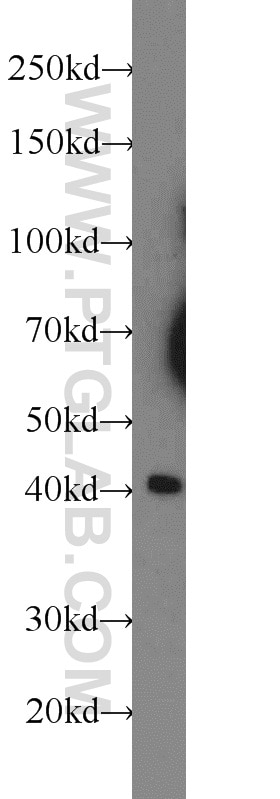 Western Blot (WB) analysis of HeLa cells using XKR6 Polyclonal antibody (23968-1-AP)