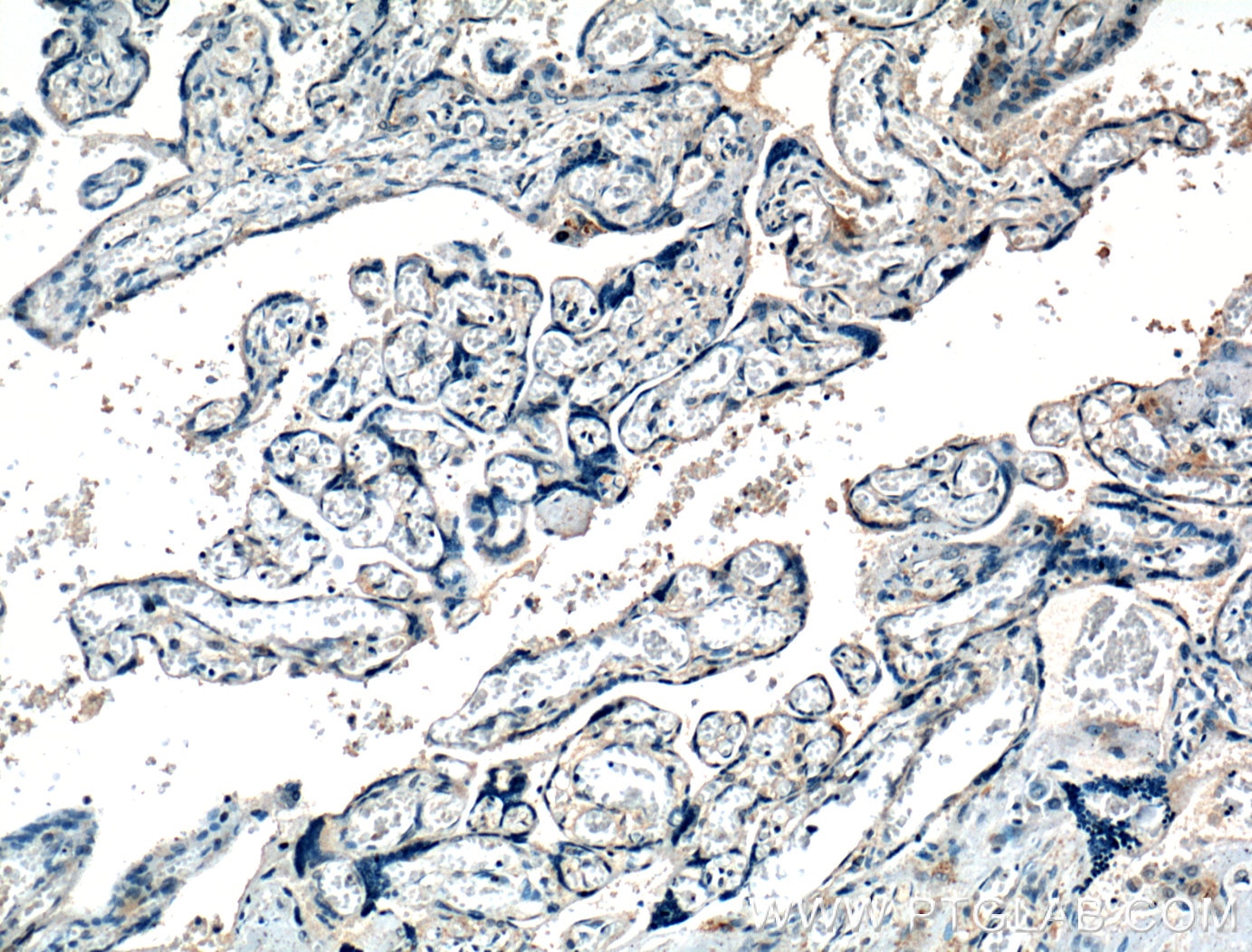 Immunohistochemistry (IHC) staining of human placenta tissue using XKRX Polyclonal antibody (27049-1-AP)