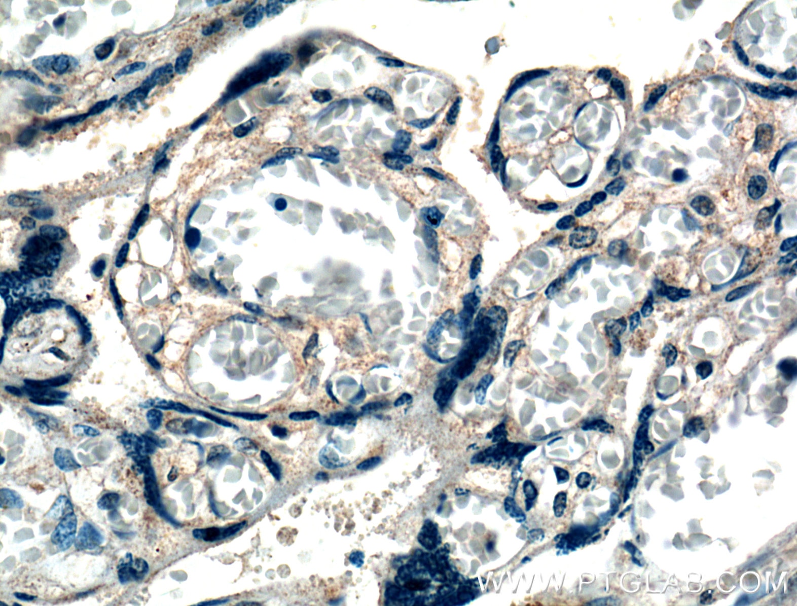 Immunohistochemistry (IHC) staining of human placenta tissue using XKRX Polyclonal antibody (27049-1-AP)