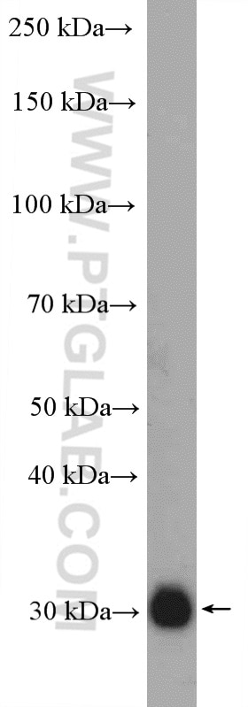 Western Blot (WB) analysis of human placenta tissue using XKRX Polyclonal antibody (27049-1-AP)