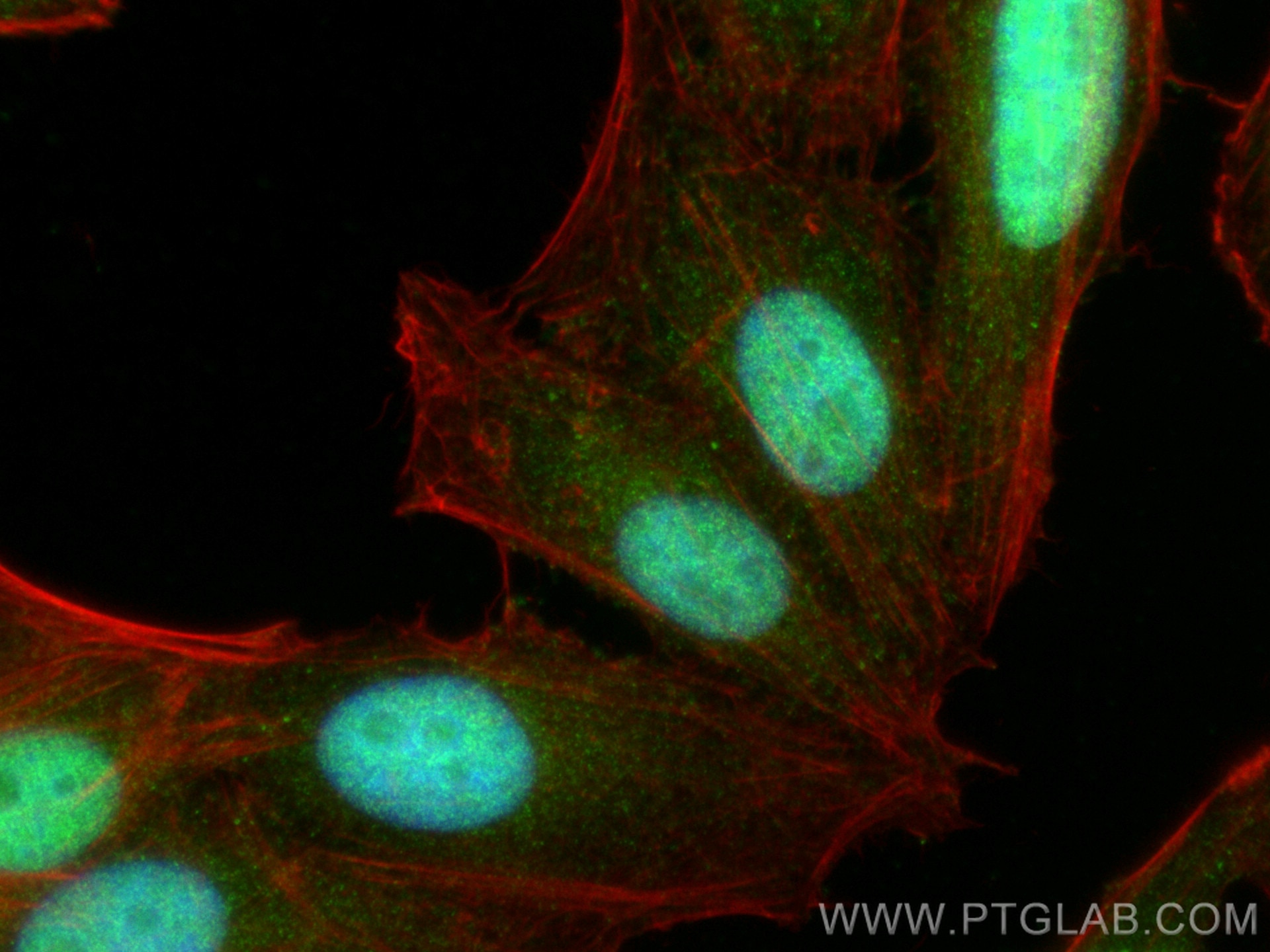 IF Staining of HepG2 using 16462-1-AP