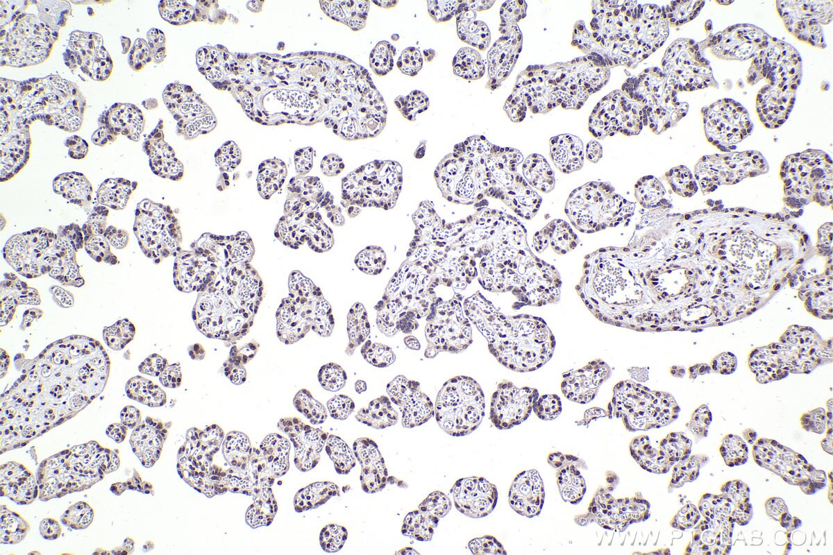 Immunohistochemistry (IHC) staining of human placenta tissue using XPA Polyclonal antibody (16462-1-AP)
