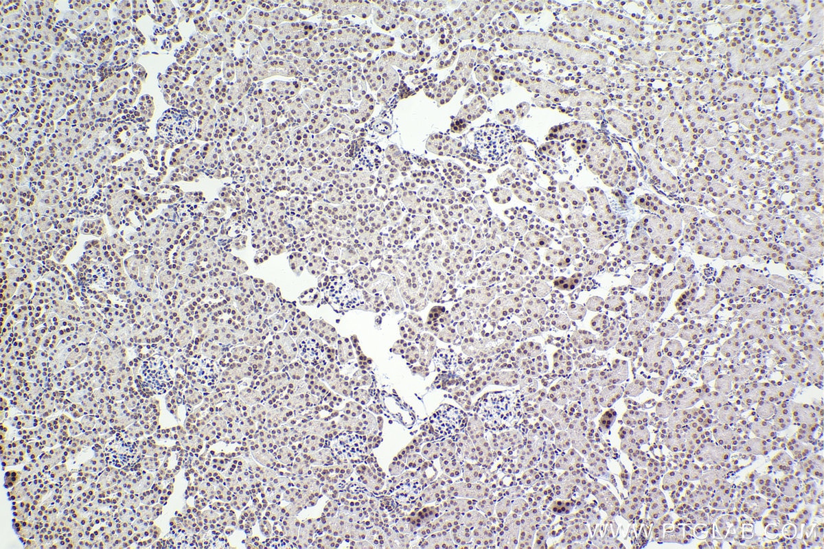 Immunohistochemistry (IHC) staining of mouse kidney tissue using XPA Polyclonal antibody (16462-1-AP)