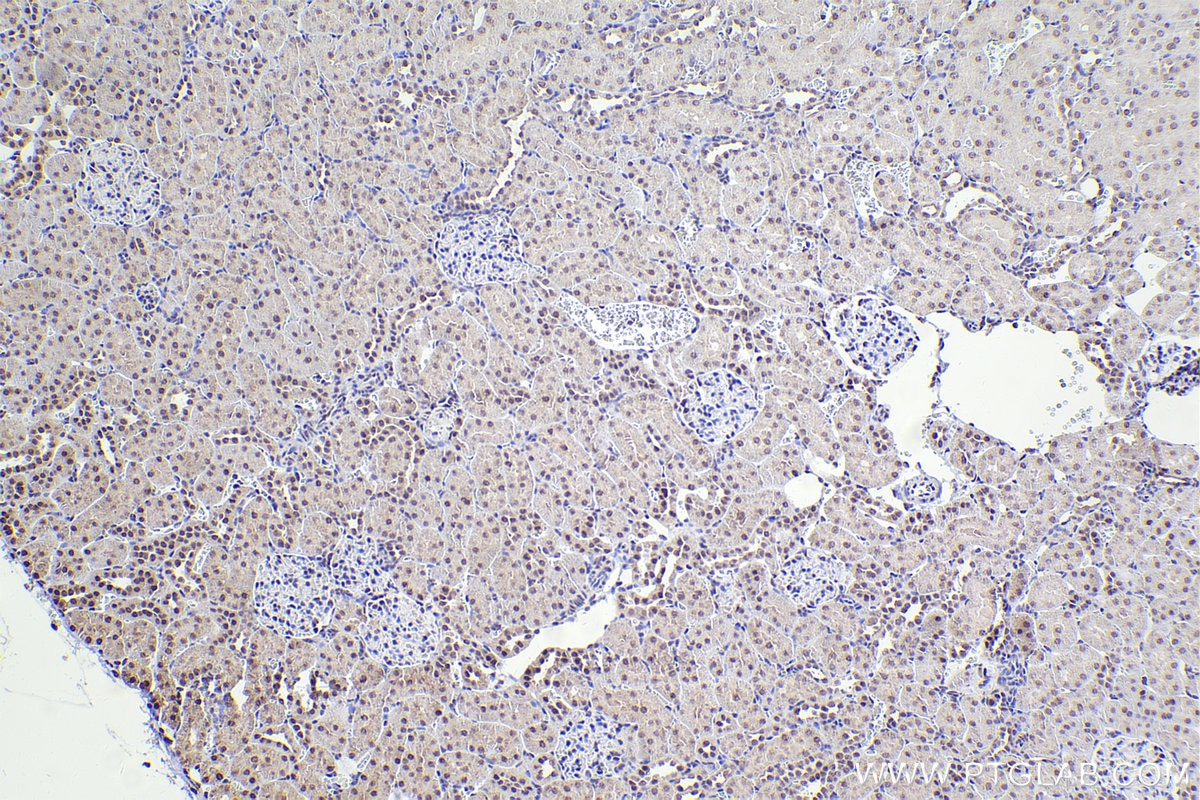 Immunohistochemistry (IHC) staining of rat kidney tissue using XPA Polyclonal antibody (16462-1-AP)