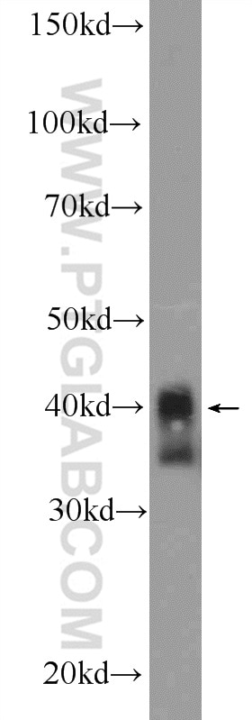 Western Blot (WB) analysis of MCF-7 cells using XPA Polyclonal antibody (16462-1-AP)