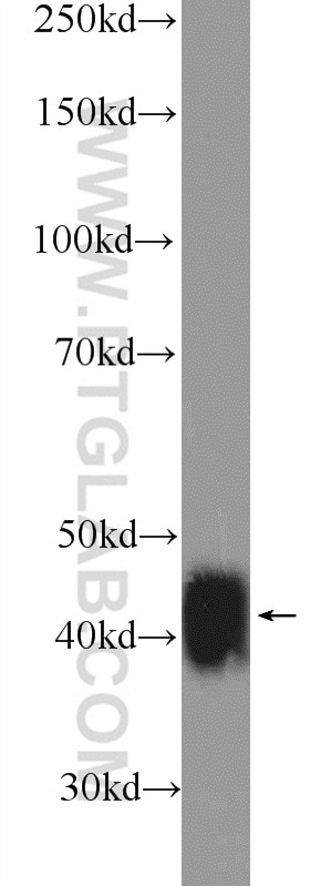 Western Blot (WB) analysis of HEK-293 cells using XPA Polyclonal antibody (16462-1-AP)