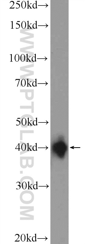 Western Blot (WB) analysis of HeLa cells using XPA Polyclonal antibody (16462-1-AP)