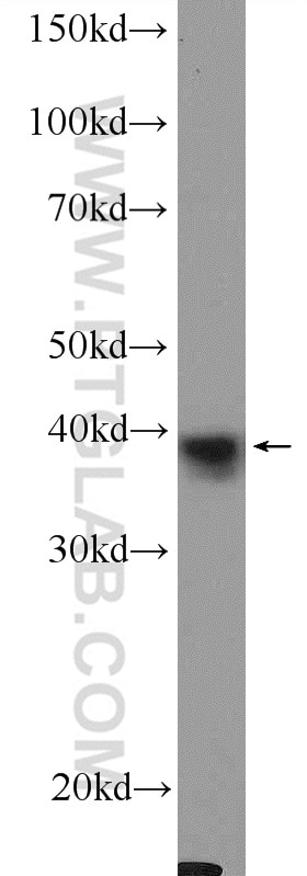 Western Blot (WB) analysis of HeLa cells using XPA Polyclonal antibody (16462-1-AP)