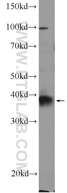 Western Blot (WB) analysis of HeLa cells using XPA Polyclonal antibody (16462-1-AP)