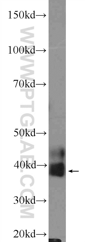 Western Blot (WB) analysis of MCF-7 cells using XPA Polyclonal antibody (16462-1-AP)