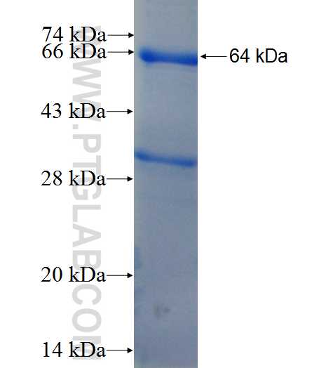 XPA fusion protein Ag9536 SDS-PAGE