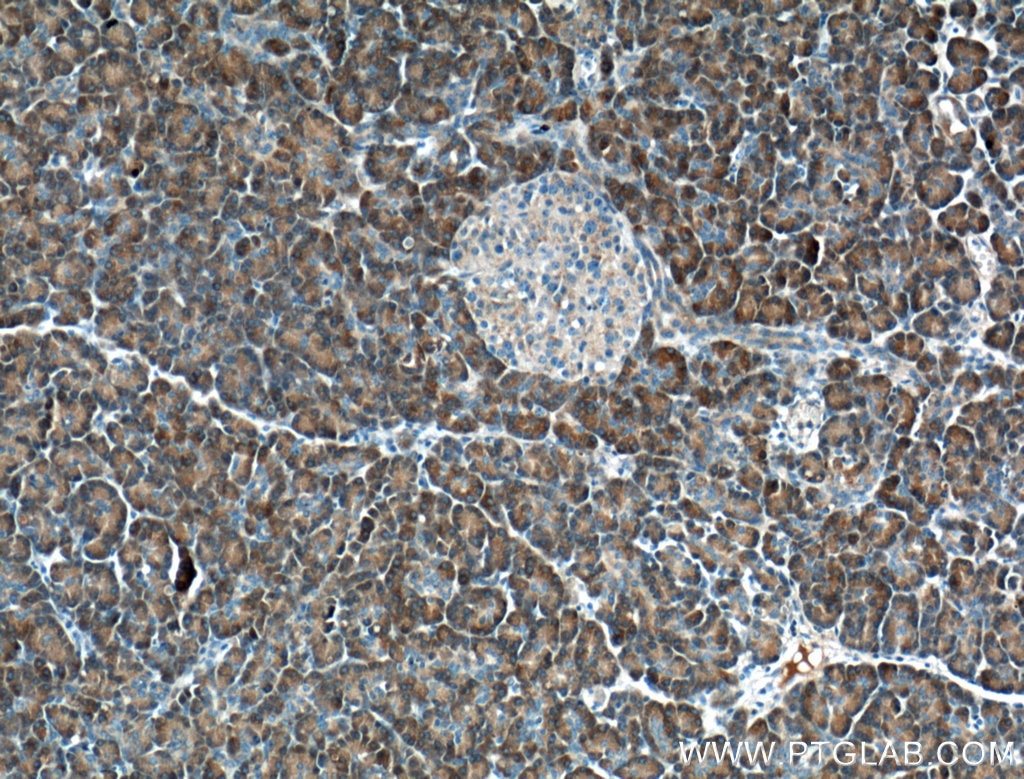 Immunohistochemistry (IHC) staining of human pancreas tissue using XPNPEP1 Polyclonal antibody (10661-1-AP)