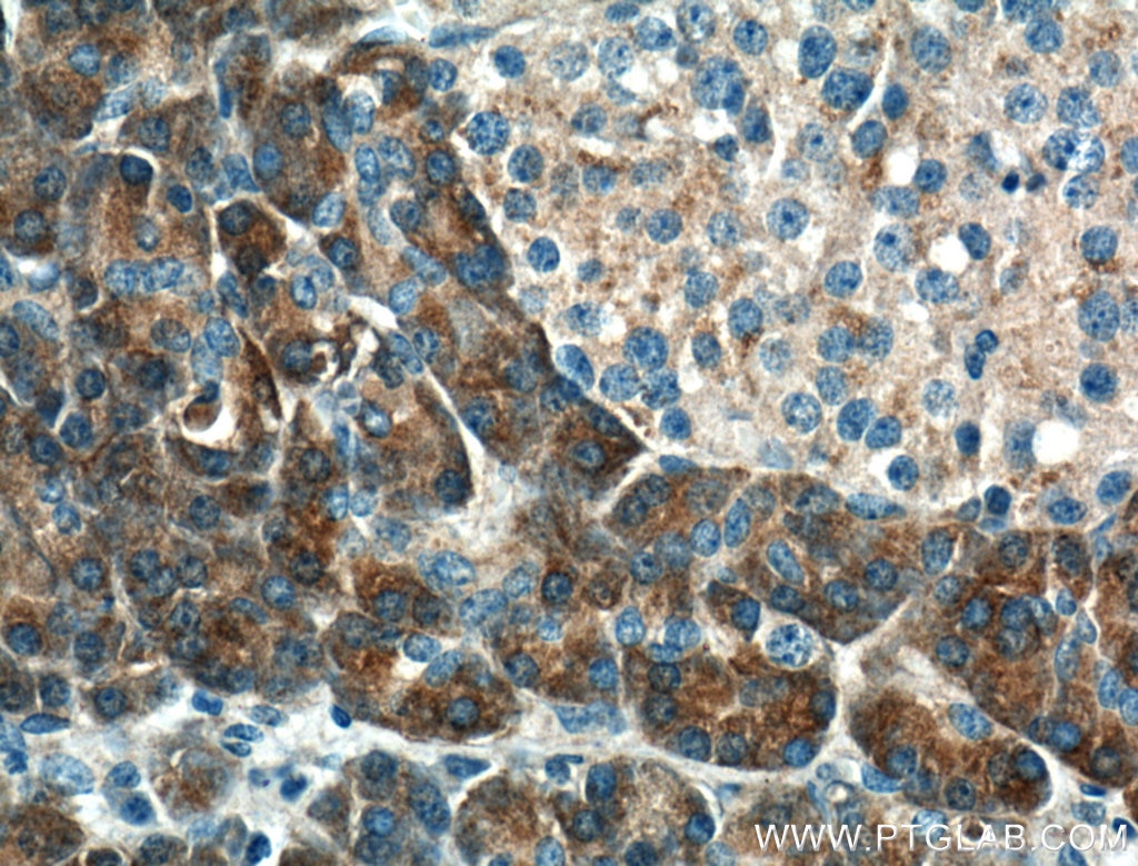 Immunohistochemistry (IHC) staining of human pancreas tissue using XPNPEP1 Polyclonal antibody (10661-1-AP)
