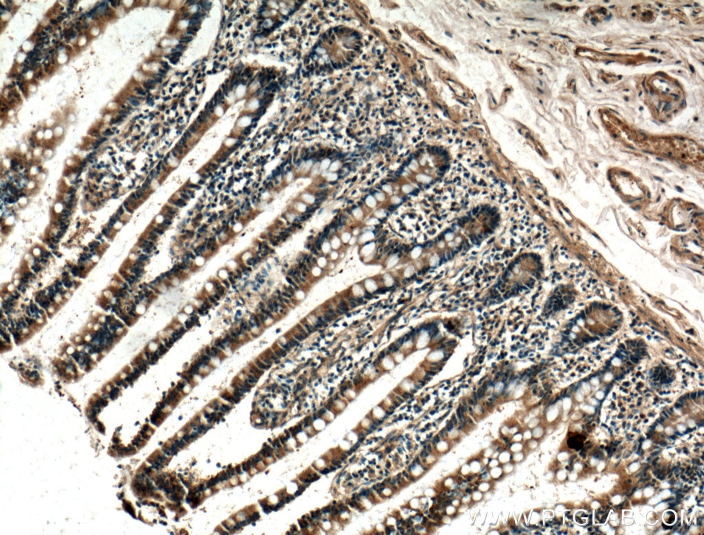 Immunohistochemistry (IHC) staining of human small intestine tissue using XPNPEP1 Polyclonal antibody (10661-1-AP)