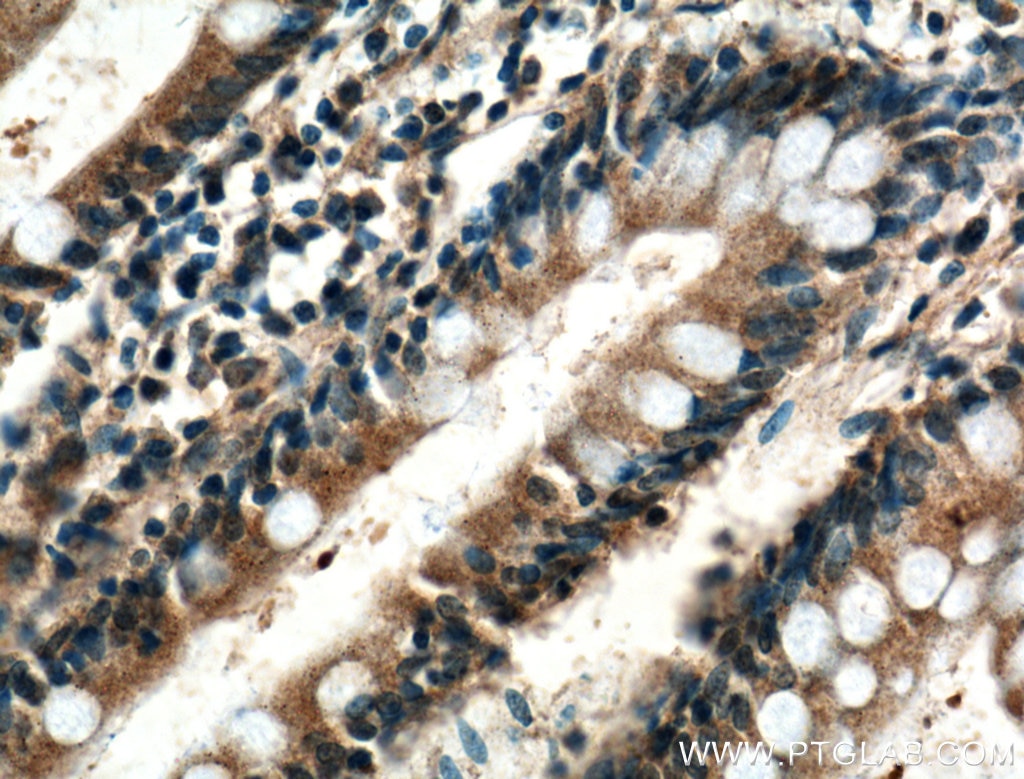 Immunohistochemistry (IHC) staining of human small intestine tissue using XPNPEP1 Polyclonal antibody (10661-1-AP)