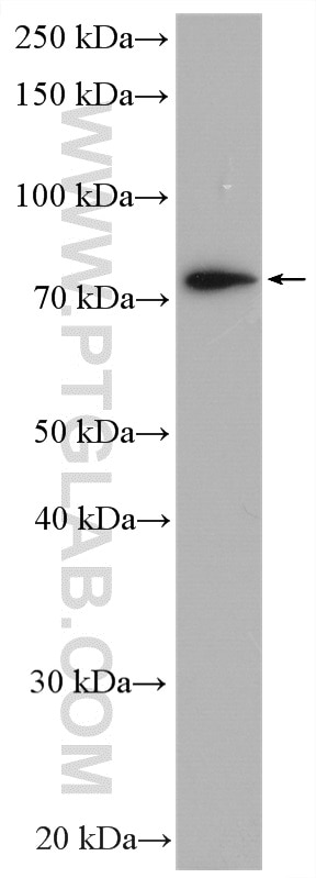 Western Blot (WB) analysis of mouse pancreas tissue using XPNPEP1 Polyclonal antibody (10661-1-AP)