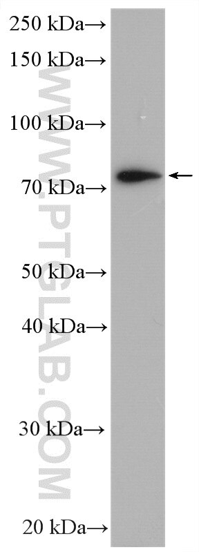 Western Blot (WB) analysis of mouse pancreas tissue using XPNPEP1 Polyclonal antibody (10661-1-AP)