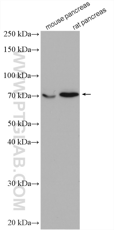 Western Blot (WB) analysis of various lysates using XPNPEP1 Polyclonal antibody (10661-1-AP)