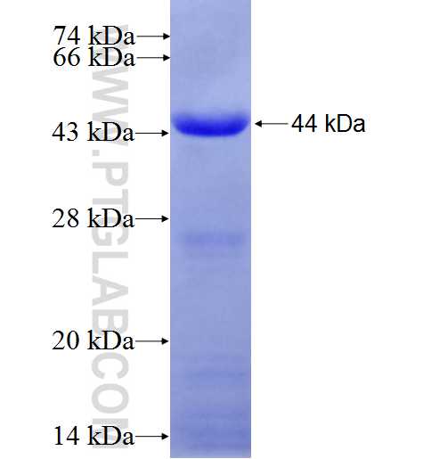 XPNPEP1 fusion protein Ag1015 SDS-PAGE