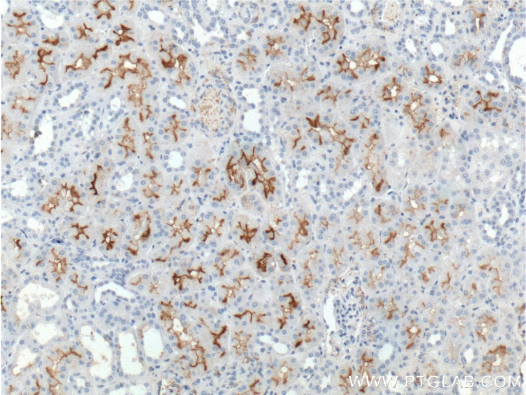 Immunohistochemistry (IHC) staining of human kidney tissue using XPNPEP2 Polyclonal antibody (25945-1-AP)